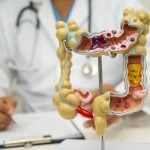 Gastroenterologist